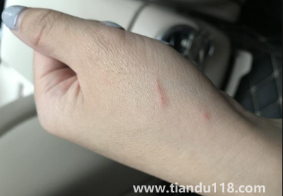 被貓抓了一下輕微破皮要打針嗎3